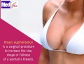 Four Reasons to Undergo Breast augmentation